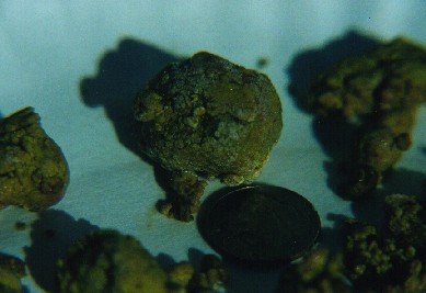 Imagen de parásito 3